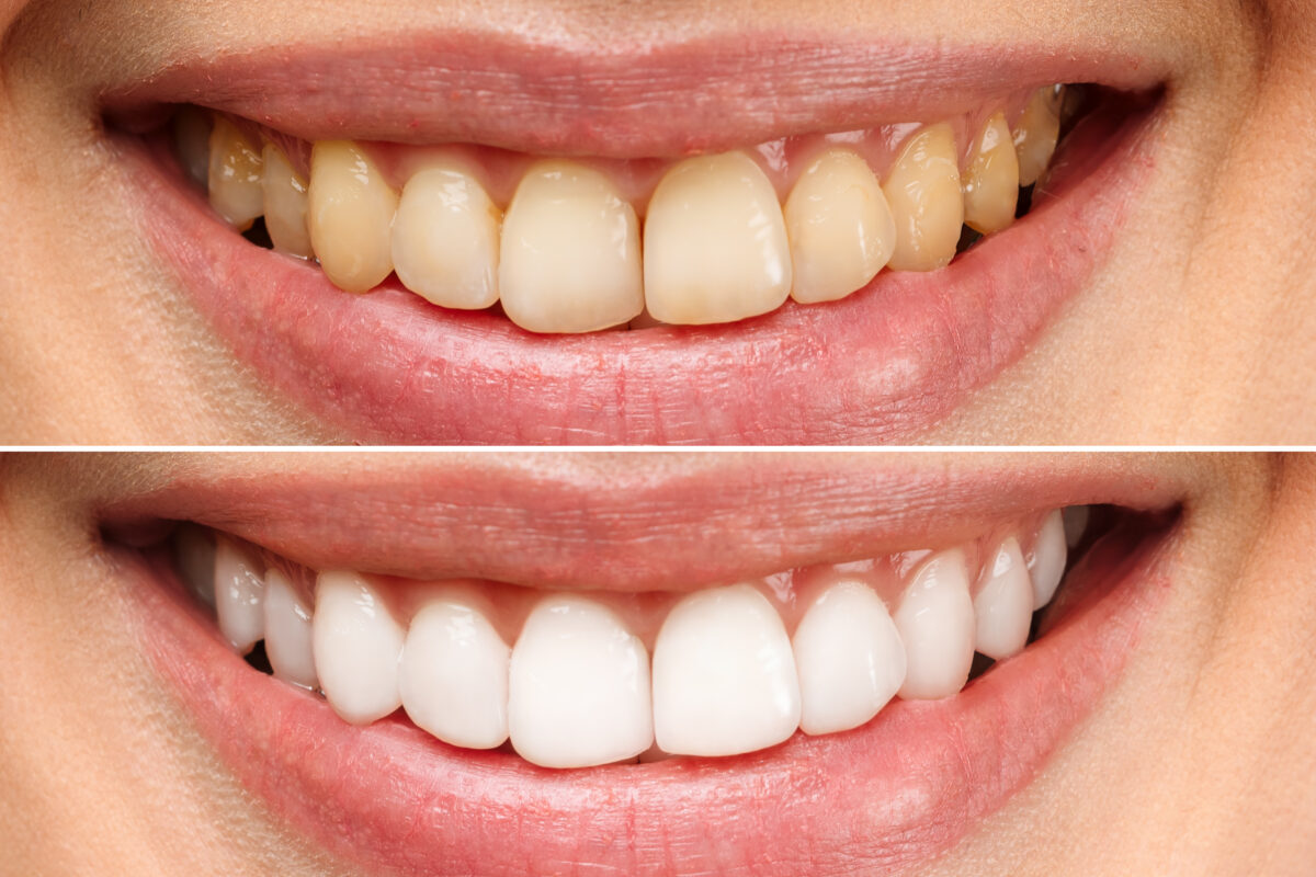 iStock-1360028172-1200x800.jpg